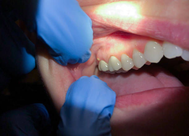 Best Emergency Dental Services for Seniors in Kingstowne, VA