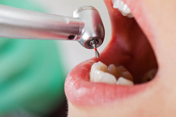 Best Emergency Dental Services for Seniors in Kingstowne, VA